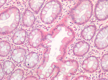 HGF/Hepatocyte Growth Factor Antibody