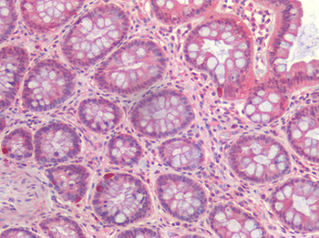 CASP3/Caspase 3 Antibody