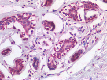 TP63/p63 Antibody