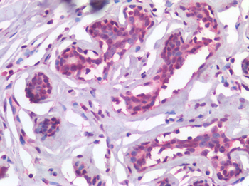 TP63/p63 Antibody