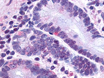 GLP2R Antibody