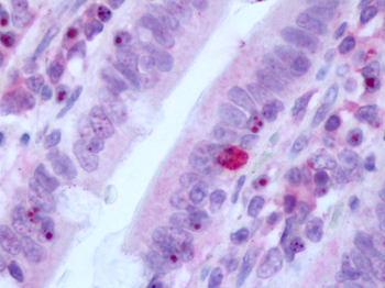 GLP2R Antibody