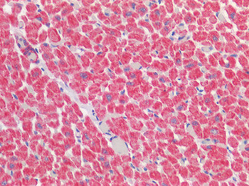 VDAC2 Antibody