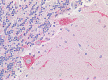 VDAC2 Antibody