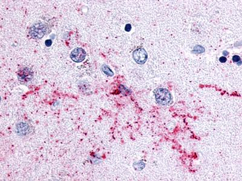 MCHR2 Antibody