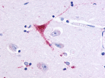OR51E1 Antibody