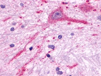 MCHR2 Antibody