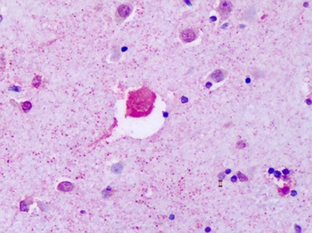 P2RY8/P2Y8 Antibody