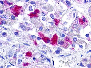 GnRH receptor/GNRHR Antibody