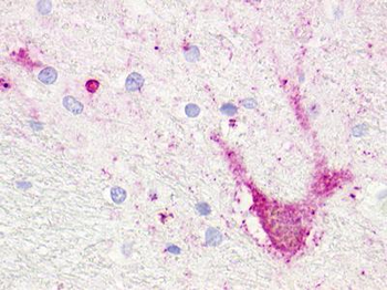 TAAR5 Antibody