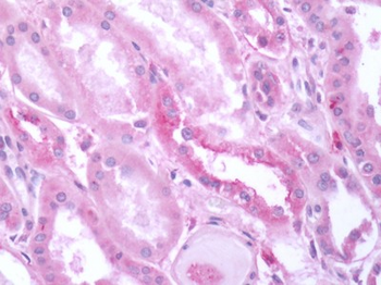 GRM3/MGLUR3 Antibody