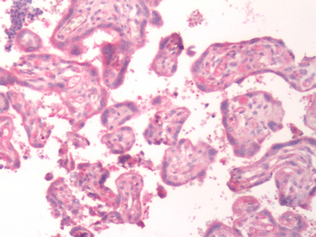 B1R/BDKRB1 Antibody