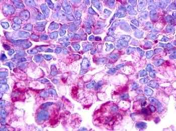 UTS2R/GPR14 Antibody