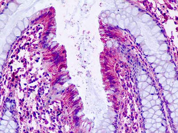 PTGER4/EP4 Antibody