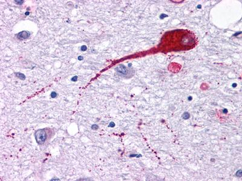NMUR2 Antibody