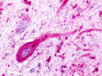 C5AR2/GPR77/C5L2 Antibody