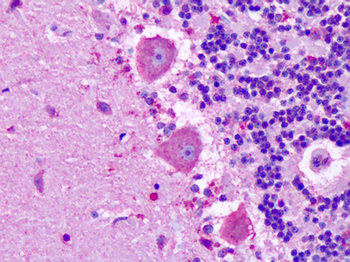 MRGPRX3/MRGX3 Antibody
