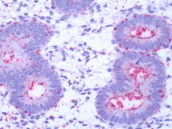 GPR50 Antibody