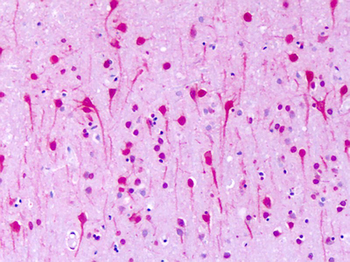 GPR1 Antibody