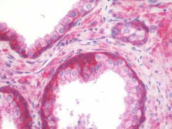 TPT1/TCTP Antibody