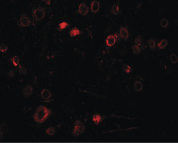 TPT1/TCTP Antibody