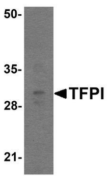 TFPI/LACI Antibody