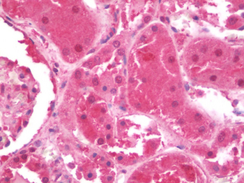 ARSB/Arylsulfatase B Antibody
