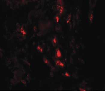 ARSB/Arylsulfatase B Antibody
