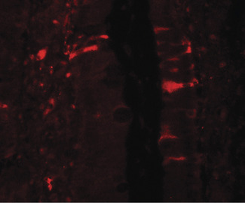 IL36RN/IL1F5 Antibody