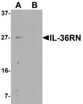 IL36RN/IL1F5 Antibody