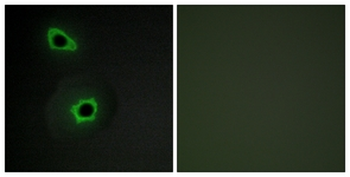 COL7A1/Collagen VII Antibody