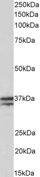 TNNT1/TNT Antibody
