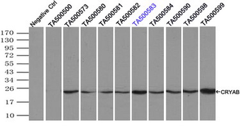 CRYAB/Alpha B Crystallin Antibody