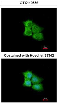 PCMT1 Antibody