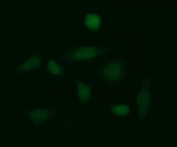 GLB1/Beta-Galactosidase Antibody