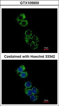 GSTA2 Antibody