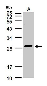 GSTA2 Antibody