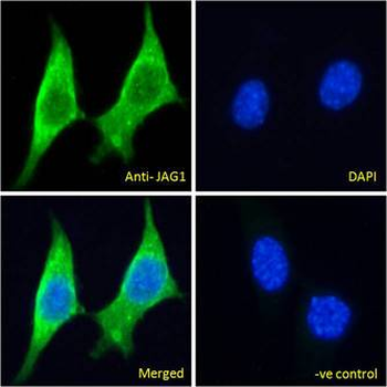 JAG1/Jagged 1 Antibody