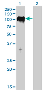 MPS1/TTK Antibody