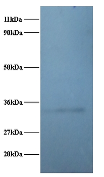 RPL5/Ribosomal Protein L5 Antibody