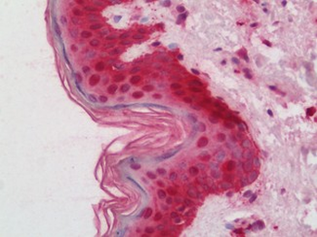 HHEX/HEX Antibody