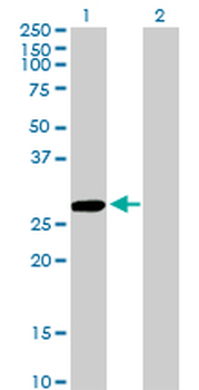 CCBL1 Antibody