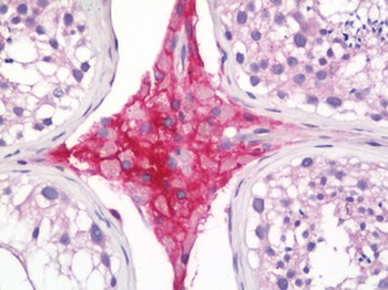 Betaglycan/TGFBR3 Antibody