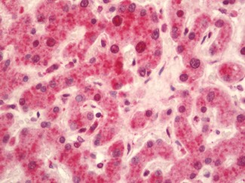 NR2F1/Coup-TF Antibody