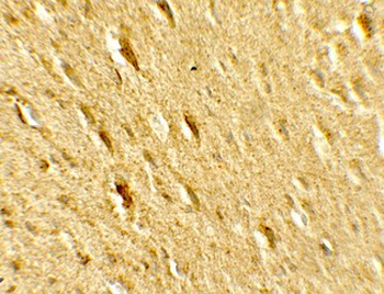 GABARAPL2/ATG8 Antibody