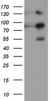 FOLH1/PSMA Antibody