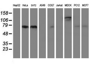 FOLH1/PSMA Antibody