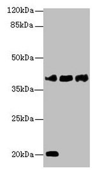 STEAP1/STEAP Antibody