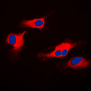 ORAOV1 Antibody