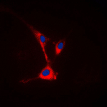 TUSC3 Antibody